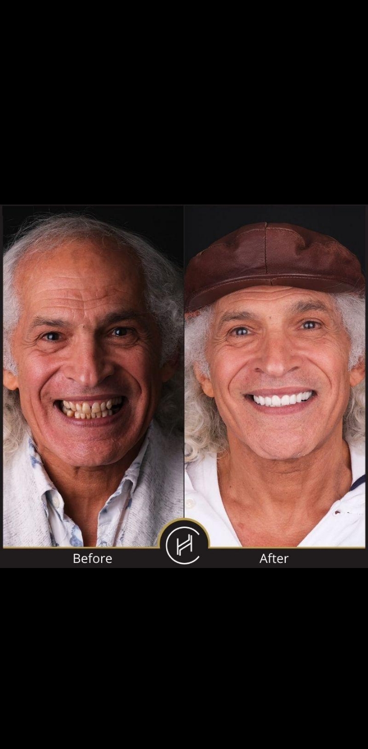 طب أسنان الأطفال