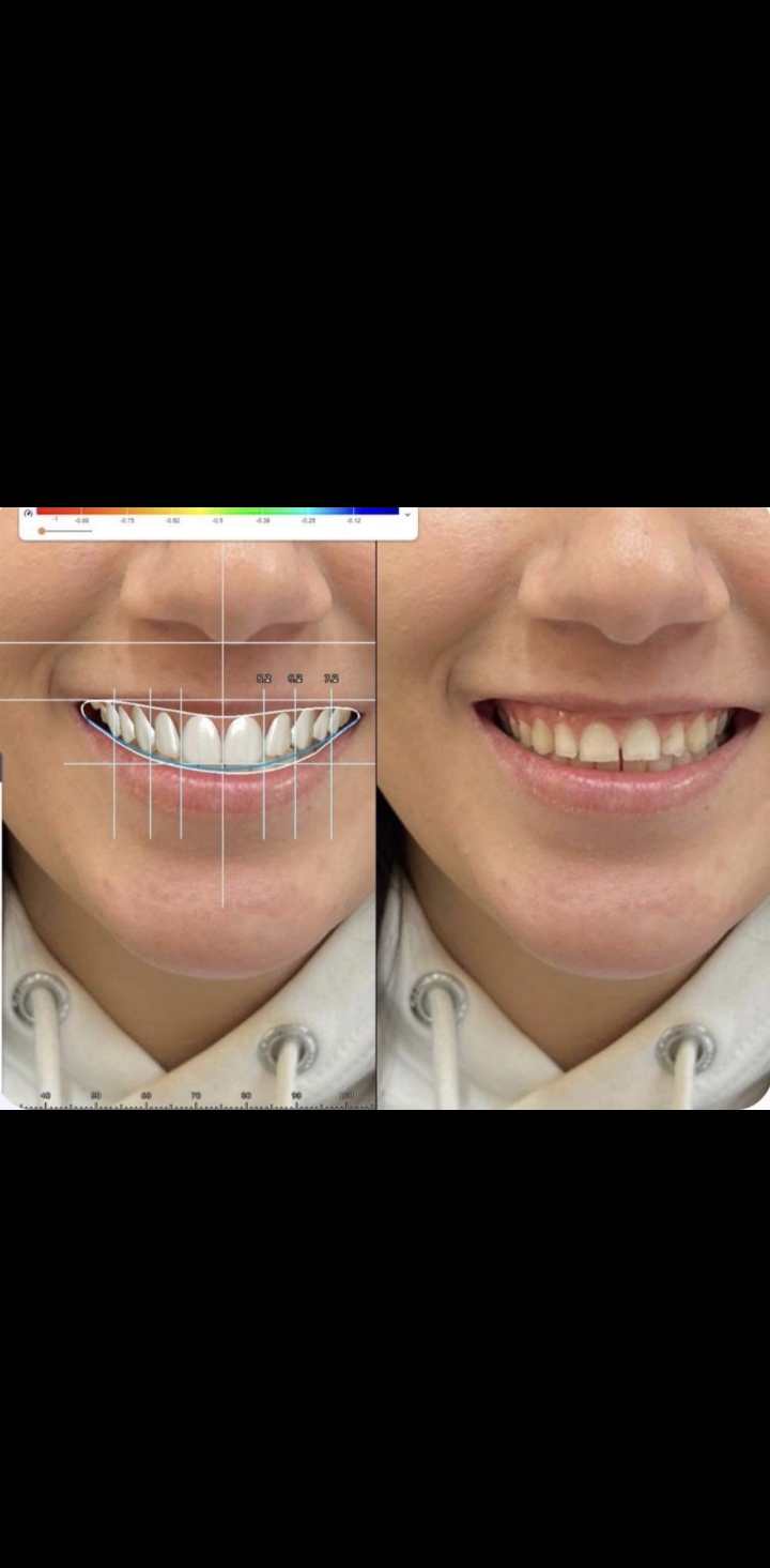 مقارنة بين الأشعة التقليدية ثنائية الأبعاد والتصوير ثلاثي الأبعاد CBCT